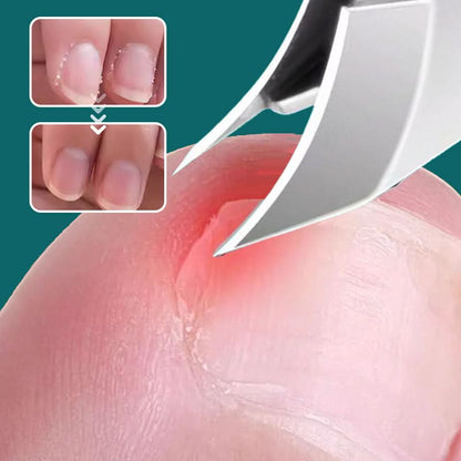💅 50% KORTING NU! ✨ Anti-spat 25° nagelknipper met schuine rand, 3-delige set – precies knippen, comfortabele grip en veilige spatbescherming ✂️