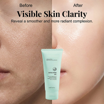 🥳2026 HOT SALE🥳💞50K+ VERKOCHT!💥👵🌸 50% KORTING! Kruidenextract Verhelderende Exfoliërende Gel