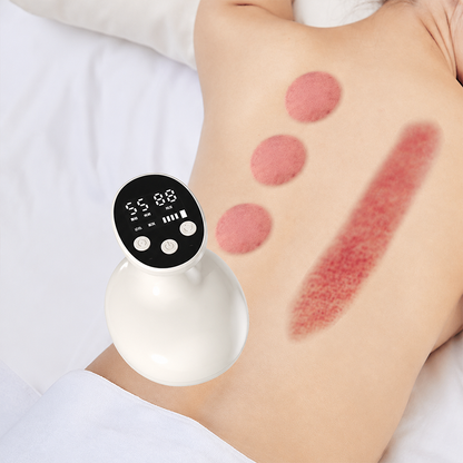 🧖‍♀️  2026New Arrival 50% Off 💆 Heated Vacuum Cupping Massager🌿🏠